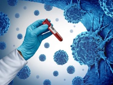 Early-detection-blood-test